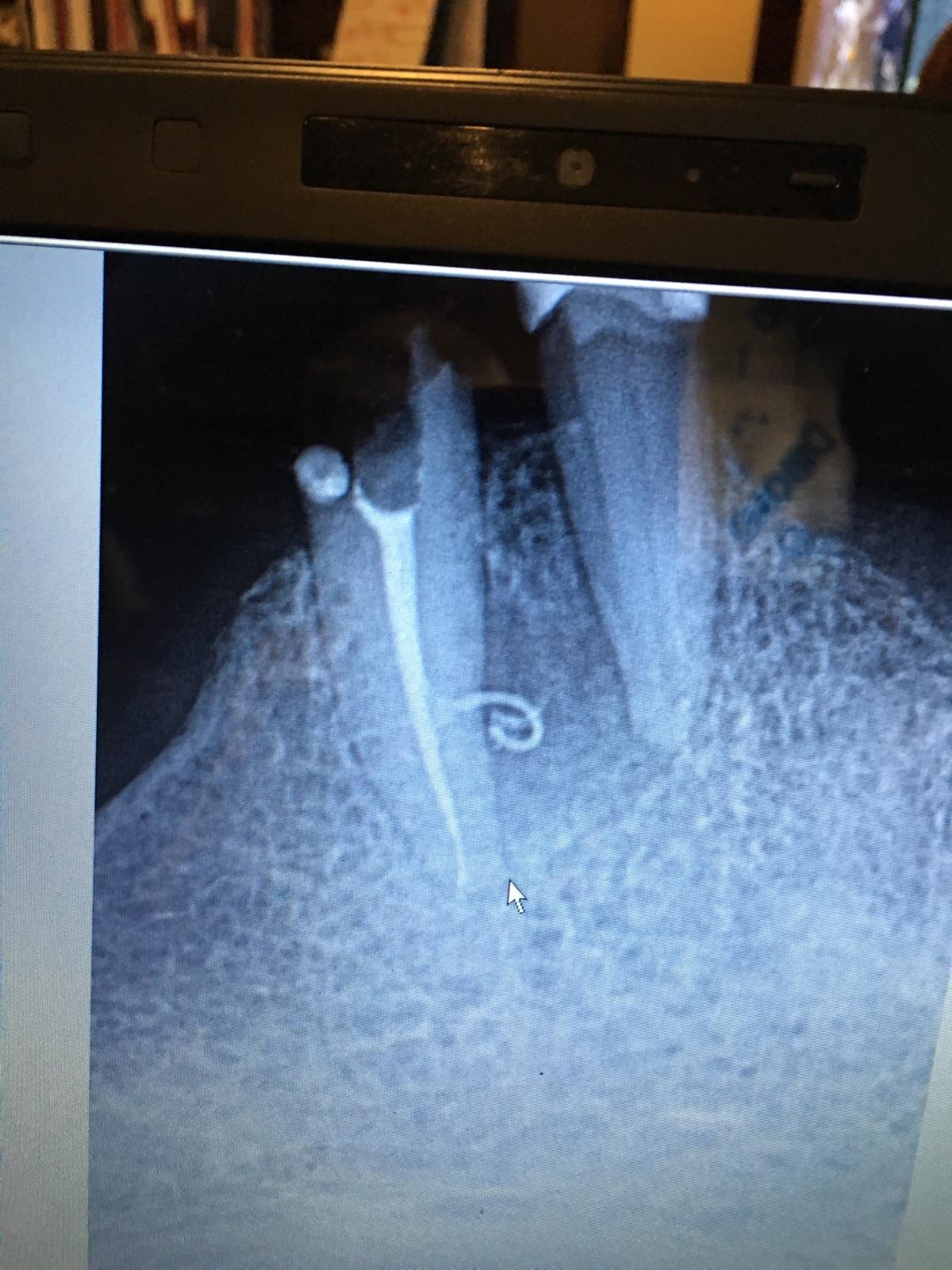 Sweeps — Lateral Canal Case