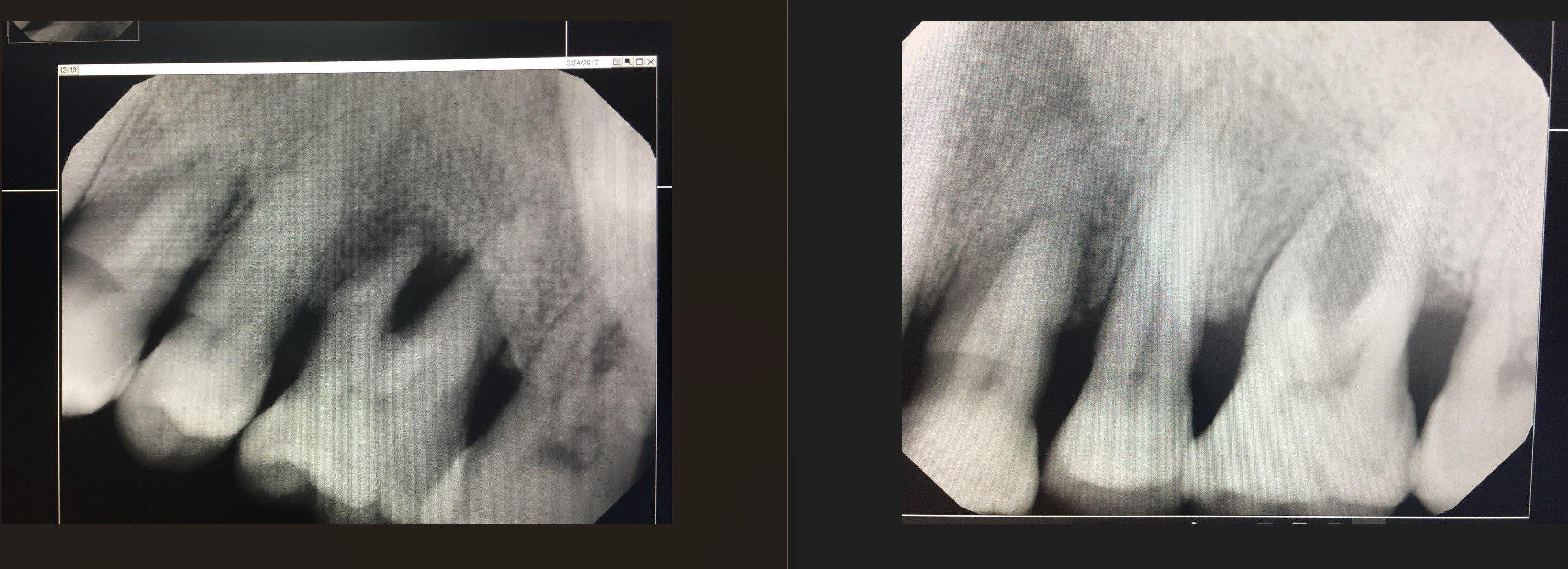 Perio Before & After